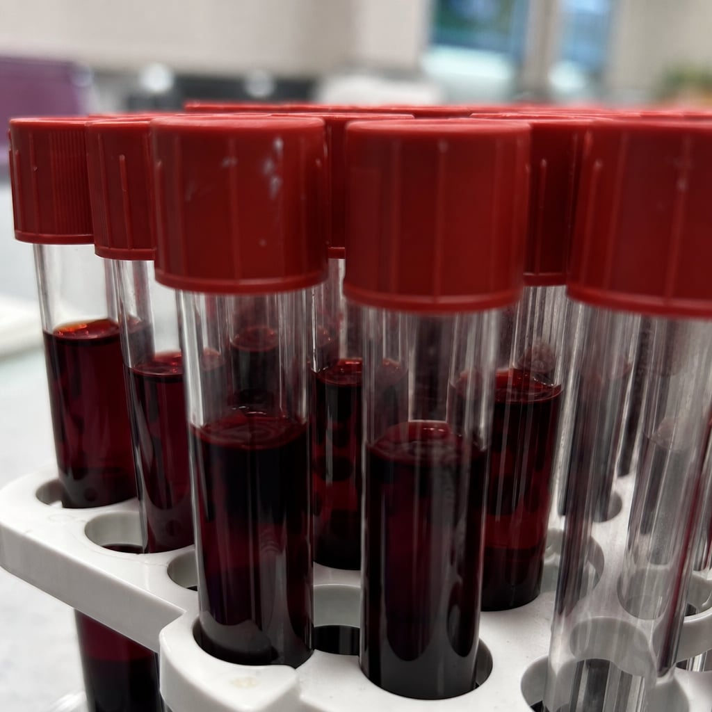Only 43 People Alive Have This Blood Type